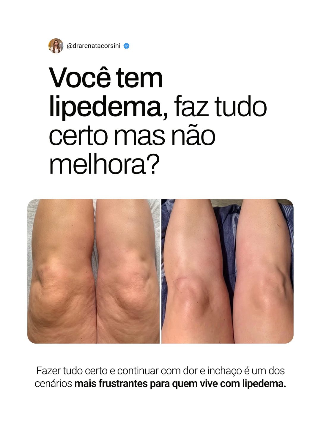 Arte de Instagram produzida para Dra. Renata Corsini